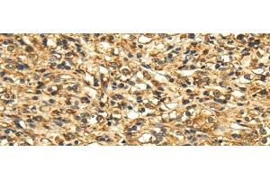 Immunohistochemistry (Paraffin-embedded Sections) (IHC (p)) image for anti-Solute Carrier Family 6 (Neutral Amino Acid Transporter), Member 19 (SLC6A19) antibody (ABIN7244294)