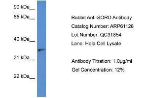 Western Blotting (WB) image for anti-Sorbitol Dehydrogenase (SORD) (N-Term) antibody (ABIN2788686) (SORD 抗体  (N-Term))
