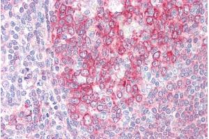 ABIN184723 (5µg/ml) staining of paraffin embedded Human Tonsil. (SWAP70 抗体  (C-Term))