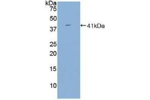 Detection of Recombinant BAFFR, Human using Polyclonal Antibody to B-Cell Activation Factor Receptor (BAFFR) (BAFF 抗体  (AA 96-184))