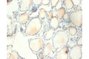 Immunohistochemistry of paraffin-embedded human thyroid tissue using ABIN7142488 at dilution of 1:100 (RPS13 抗体  (AA 3-151))