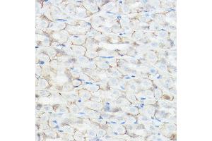 Immunohistochemistry (IHC) image for anti-gamma-aminobutyric Acid (GABA) A Receptor, alpha 2 (GABRA2) (AA 300-400) antibody (ABIN3022576)