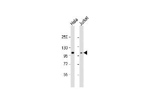 All lanes : Anti-RB1 Antibody (C-term) at 1:8000 dilution Lane 1: Hela whole cell lysate Lane 2: Jurkat whole cell lysate Lysates/proteins at 20 μg per lane. (Retinoblastoma 1 抗体  (C-Term))