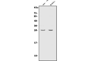 Western blot analysis of CINP using anti-CINP antibody (ABIN7603167).