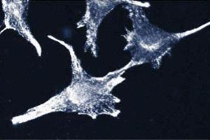 Immunofluorescence staining of CPAE cells (bovine pulmonary artery endothelial cells, ATCC CCL-209). (PTPRZ1 抗体  (AA 2098-2307))