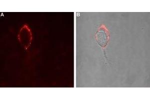 Immunocytochemistry (ICC) image for anti-gamma-aminobutyric Acid (GABA) A Receptor, alpha 4 (GABRA4) (AA 37-50), (Extracellular) antibody (ABIN7043188)