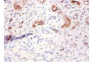 Immunohistochemistry of paraffin-embedded human kidney tissue using ABIN7143786 at dilution of 1:100 (Fetuin A 抗体  (AA 20-296))