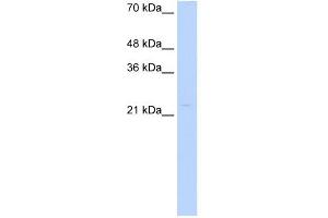 WB Suggested Anti-CDX4 Antibody Titration: 0. (CDX4 抗体  (Middle Region))