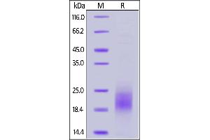 Human PSCA, His Tag on  under reducing (R) condition. (PSCA Protein (AA 12-86) (His tag))