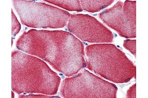 anti-Heat Shock 27kDa Protein Family, Member 7 (Cardiovascular) (HSPB7) (AA 1-171) antibody