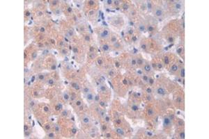 IHC-P analysis of Human Liver Tissue, with DAB staining.
