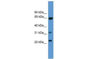 WB Suggested Anti-CLTA Antibody Titration: 0. (CLTA 抗体  (C-Term))