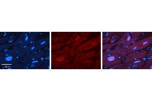 Rabbit Anti-ERF Antibody   Formalin Fixed Paraffin Embedded Tissue: Human heart Tissue Observed Staining: Nucleus Primary Antibody Concentration: 1:100 Other Working Concentrations: 1:600 Secondary Antibody: Donkey anti-Rabbit-Cy3 Secondary Antibody Concentration: 1:200 Magnification: 20X Exposure Time: 0. (ERF 抗体  (N-Term))
