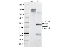 SDS-PAGE Analysis Purified CD71 Mouse Monoclonal Antibody (TFRC/1839). (Transferrin Receptor 抗体  (AA 94-212))