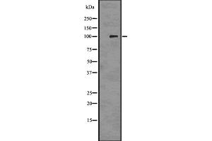 Western blot analysis of PMEL17 / GP100 using 293 whole cell lysates (Melanoma gp100 抗体  (C-Term))