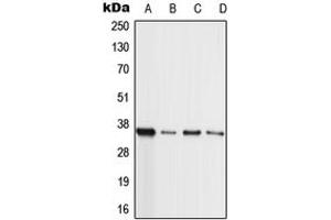 Western blot analysis of MLL4 expression in HL60 (A), A549 (B), NIH3T3 (C), H9C2 (D) whole cell lysates. (MLL4 抗体  (Center))