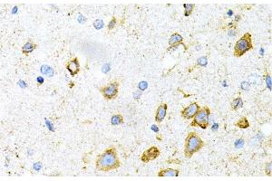 Immunohistochemistry of paraffin-embedded Mouse brain using LRPAP1 Polyclonal Antibody at dilution of 1:200 (40x lens).