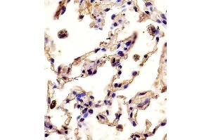 Antibody staining MMP12 in human lung tissue sections by Immunohistochemistry (IHC-P - paraformaldehyde-fixed, paraffin-embedded sections). (MMP12 抗体  (C-Term))