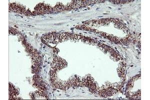 Image no. 4 for anti-Retinaldehyde Binding Protein 1 (RLBP1) antibody (ABIN1497622) (RLBP1 抗体)