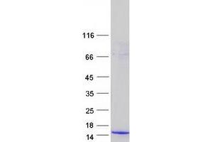 Western Blotting (WB) image for Phorbol-12-Myristate-13-Acetate-Induced Protein 1 (PMAIP1) protein (Myc-DYKDDDDK Tag) (ABIN2727491)