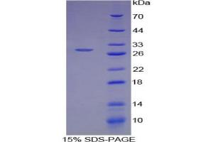 SDS-PAGE analysis of Human ATF4 Protein. (ATF4 蛋白)