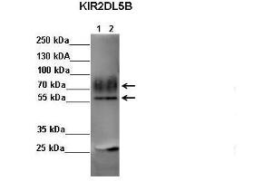 Sample Type: Lane 1: FALG IP'd FLAG-KIR2DL4 transfected NK92 cells Lane 2: FALG IP'd FLAG-KIR2DL5 transfected NK92 cells Primary Antibody Dilution: 1:500Secondary Antibody: Anti-rabbit-HRP Secondary Antibody Dilution: 1:00,000 Color/Signal Descriptions: KIR2DL5B  Gene Name: Kerry S. (KIR2DL5B 抗体  (C-Term))