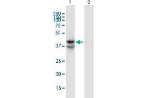 Western Blot analysis of LDHAL6B expression in transfected 293T cell line by LDHAL6B monoclonal antibody (M01), clone 1A3. (LDHAL6B 抗体  (AA 282-381))