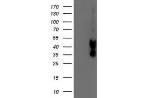 Western Blotting (WB) image for anti-Prenyl (Decaprenyl) Diphosphate Synthase, Subunit 2 (PDSS2) antibody (ABIN1500141) (PDSS2 抗体)