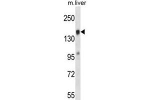 Western Blotting (WB) image for anti-T-Cell Lymphoma Invasion and Metastasis 2 (TIAM2) antibody (ABIN2997432)