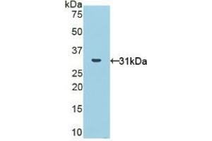 Detection of Recombinant NOX1, Human using Polyclonal Antibody to Nicotinamide Adenine Dinucleotide Phosphate Oxidase 1 (NOX1) (NOX1 抗体  (AA 235-488))