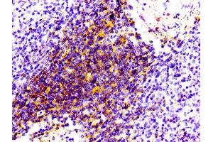 IHC image of ABIN7127280 diluted at 1:100 and staining in paraffin-embedded human spleen tissue performed on a Leica BondTM system. (Recombinant CD4 抗体)