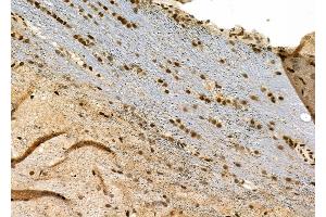 ABIN6263548 and ABIN6277572 at 1/100 staining Rat brain tissue by IHC-P. (NDC80 抗体  (C-Term))