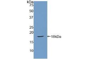 Western blot analysis of recombinant Rat SFRP1. (SFRP1 抗体  (AA 8-153))
