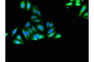 Immunofluorescent analysis of HepG2 cells using ABIN7175662 at dilution of 1:100 and Alexa Fluor 488-congugated AffiniPure Goat Anti-Rabbit IgG(H+L) (SORCS2 抗体  (AA 712-786))