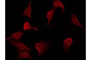 ABIN6267550 staining HepG2 by IF/ICC. (BMX 抗体  (pTyr566))
