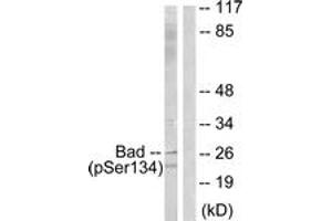 Western blot analysis of extracts from mouse liver, using BAD (Phospho-Ser134) Antibody. (BAD 抗体  (pSer134))