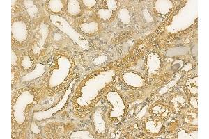 ABIN6264846 and ABIN6273312 at 1/100 staining human normal kidney tissue by IHC-P. (RPS14 抗体  (Internal Region))