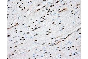 Immunohistochemical staining of paraffin-embedded liver tissue using anti-ACSBG1 mouse monoclonal antibody. (ACSBG1 抗体)