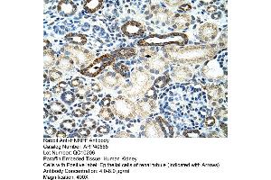 Rabbit Anti-HNRPF Antibody  Paraffin Embedded Tissue: Human Kidney Cellular Data: Epithelial cells of renal tubule Antibody Concentration: 4. (HNRNPF 抗体  (C-Term))