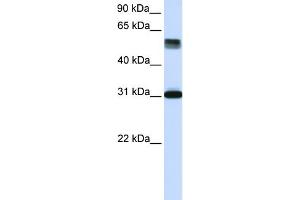 WB Suggested Anti-TRIM31 Antibody Titration: 0. (TRIM31 抗体  (Middle Region))