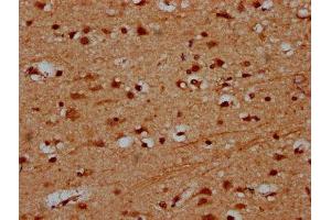 IHC image of ABIN7164105 diluted at 1:600 and staining in paraffin-embedded human brain tissue performed on a Leica BondTM system. (PRDM11 抗体  (AA 63-215))