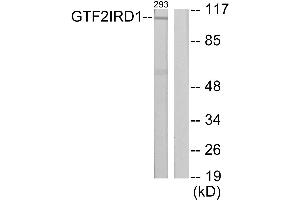 Western blot analysis of extracts from 293 cells, using GTF2IRD1 antibody. (GTF2IRD1 抗体)