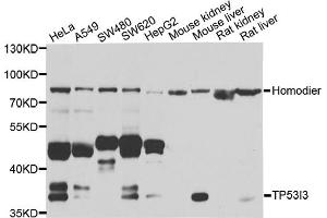 Western blot analysis of extracts of various cell lines, using TP53I3 antibody (ABIN5974745) at 1/1000 dilution. (TP53I3 抗体)