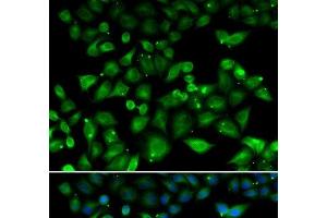Immunofluorescence analysis of HeLa cells using NHLRC1 Polyclonal Antibody (NHLRC1 抗体)