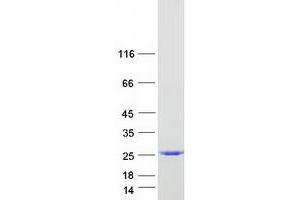 Validation with Western Blot