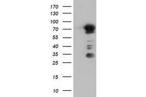 Western Blotting (WB) image for anti-rho GTPase Activating Protein 25 (ARHGAP25) antibody (ABIN1496705) (ARHGAP25 抗体)