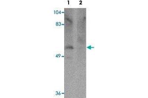 Western blot analysis of human brain tissue with PPAPDC1A polyclonal antibody  at 1 ug/mL in (Lane 1) the absence and (Lane 2) the presence of blocking peptide. (PPAPDC1A 抗体  (C-Term))