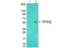 Western blot analysis of extracts from HuvEc cells (Lane 2), using TPH2 (Ab-19) antiobdy. (Tryptophan Hydroxylase 2 抗体  (Ser19))
