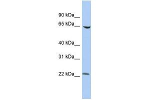 WB Suggested Anti-SCMH1 Antibody Titration:  0. (SCMH1 抗体  (Middle Region))