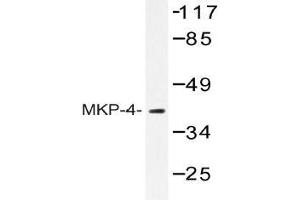 Western blot (WB) analysis of MKP-4 antibody in extracts from HeLa cells. (DUSP9 抗体)